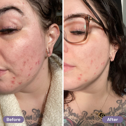 before-after