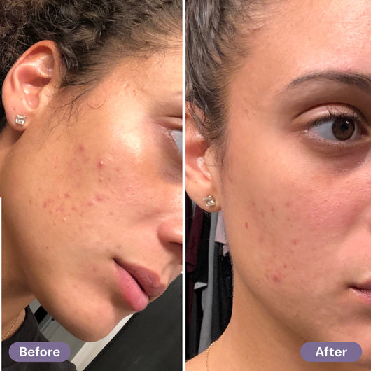 before-after