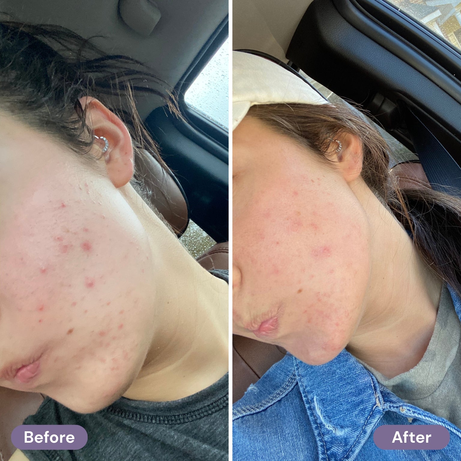 before-after