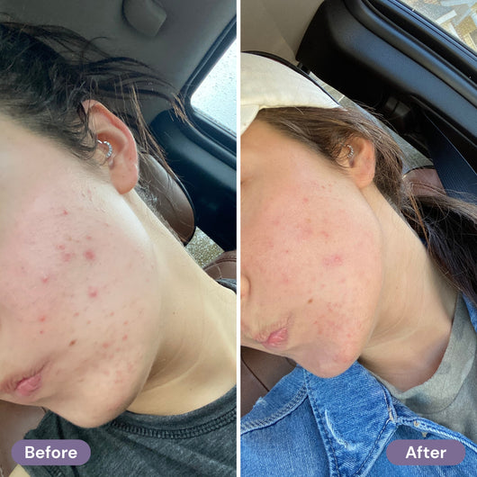 before-after