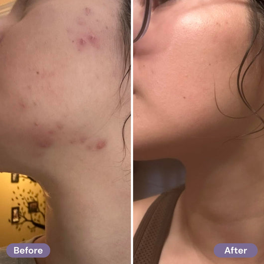 before-after