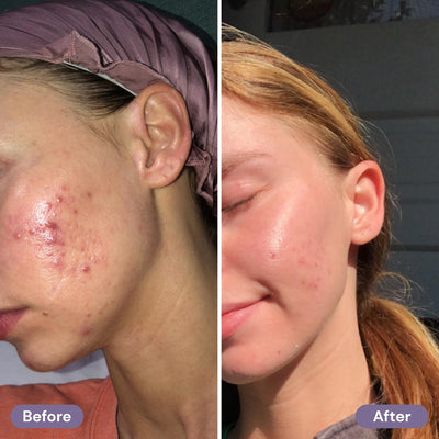 before-after
