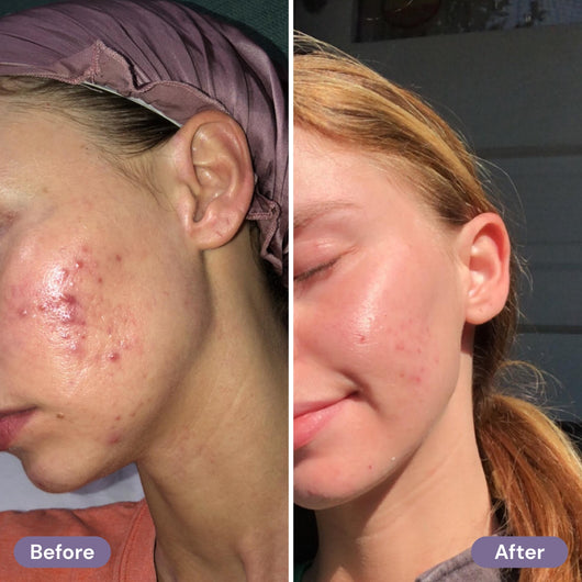 before-after